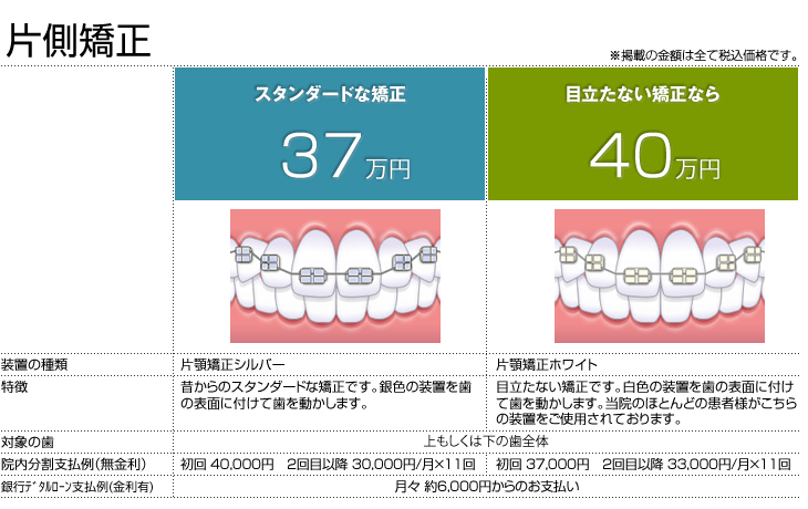 矯正治療の料金