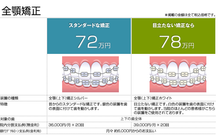 矯正治療の料金