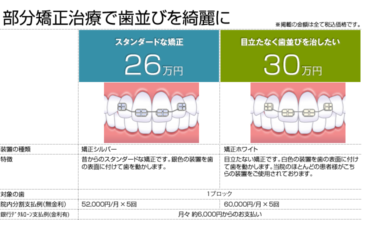 矯正治療の料金